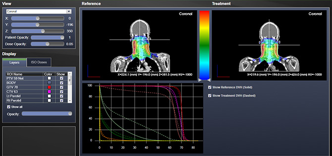 Diagnostic In-Room CT